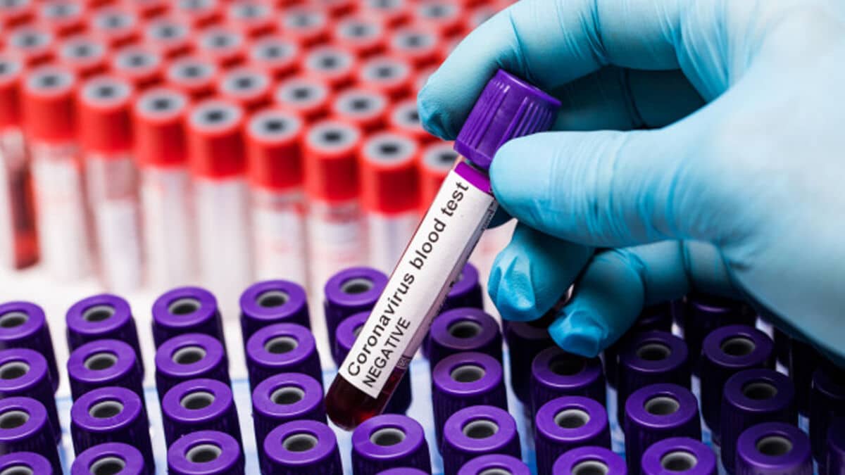 Астанада коронавирусқа шалдыққандар саны қайта көбейіп жатыр