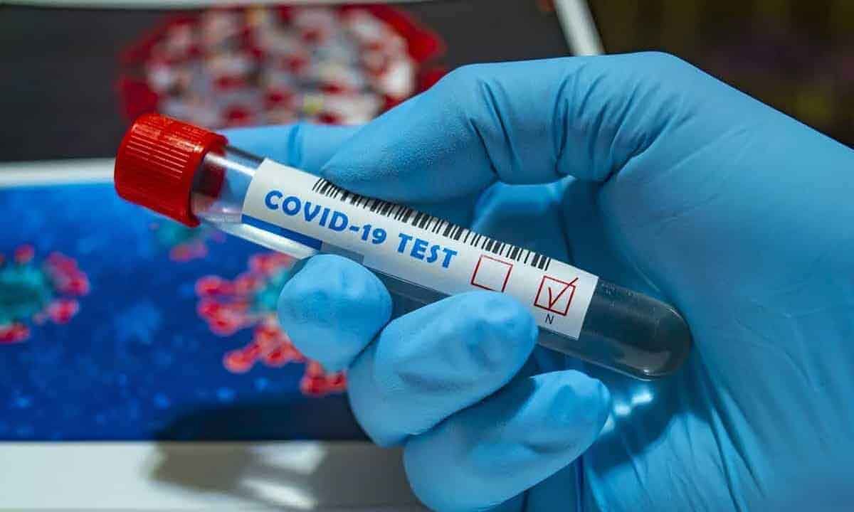 Бір тәулікте қанша адамнан коронавирус анықталды?