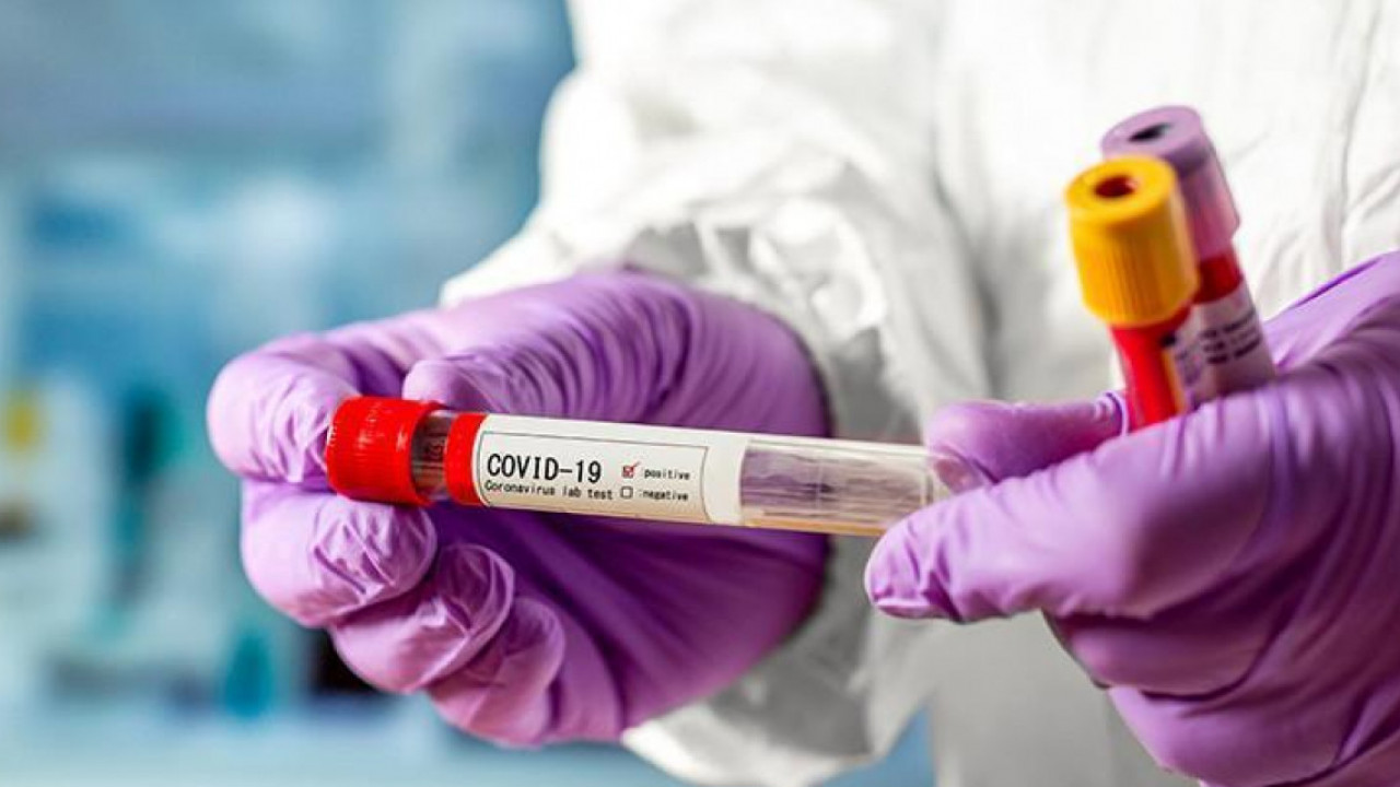 Бір күнде қанша адамнан коронавирус анықталды?