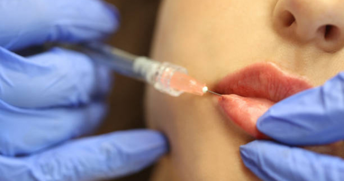 Лицензиясыз косметикалық ота жасаған елорда тұрғыны сотталды