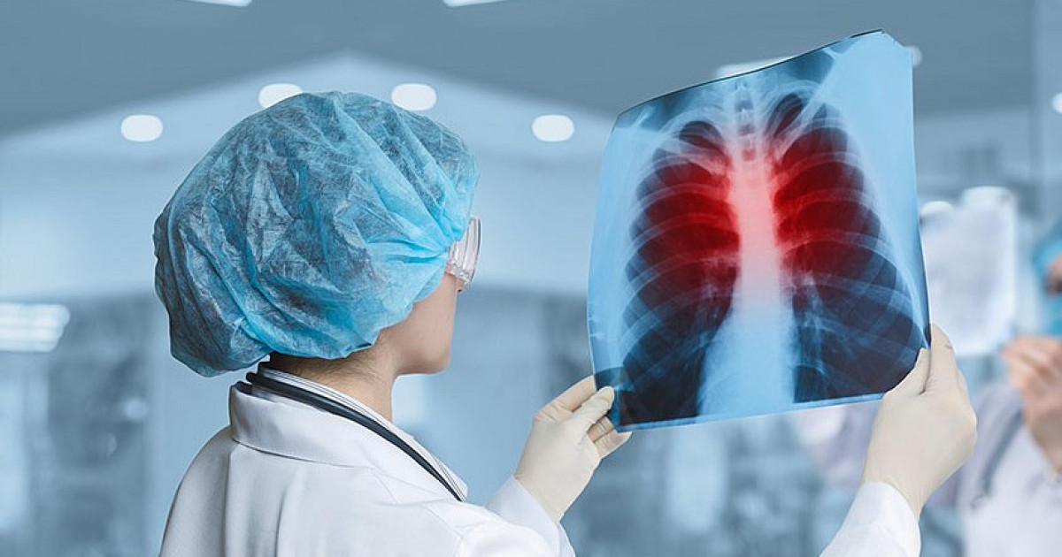 Алматы облысында мектеп оқушысынан туберкулездің ашық түрі анықталды