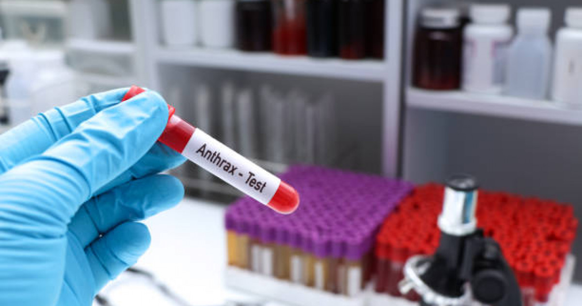 Атырауда бір адамнан сібір жарасы анықталды