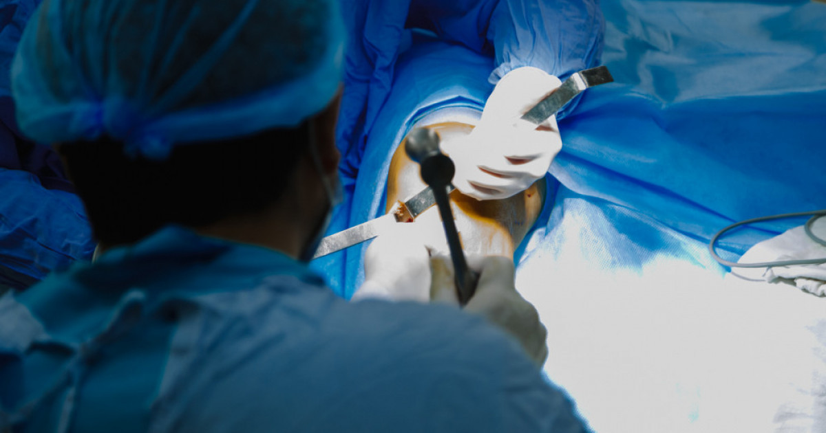 Атырауда бұрын-соңды жасалмаған тізе буынын қалпына келтіру отасы сәтті аяқталды