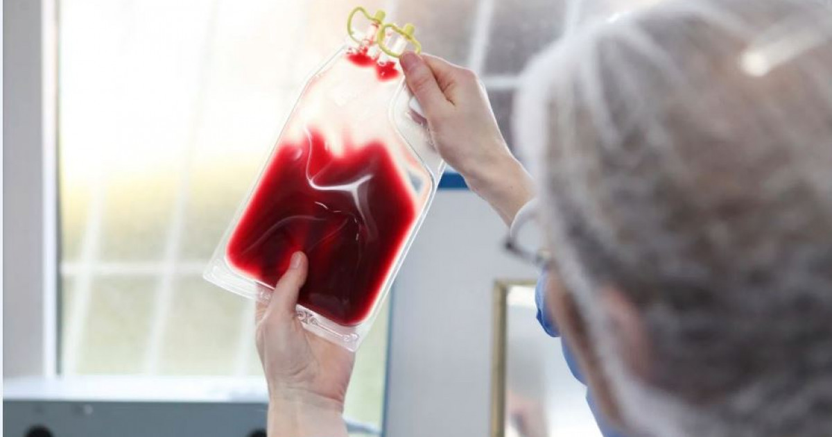 Сирек дерттiң сыры