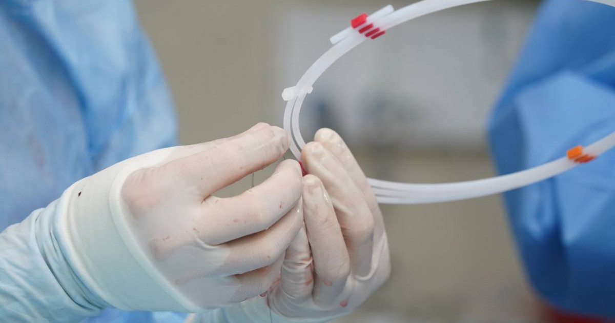 Елордада ашық жүрекке жасалған операция сәтті өтті