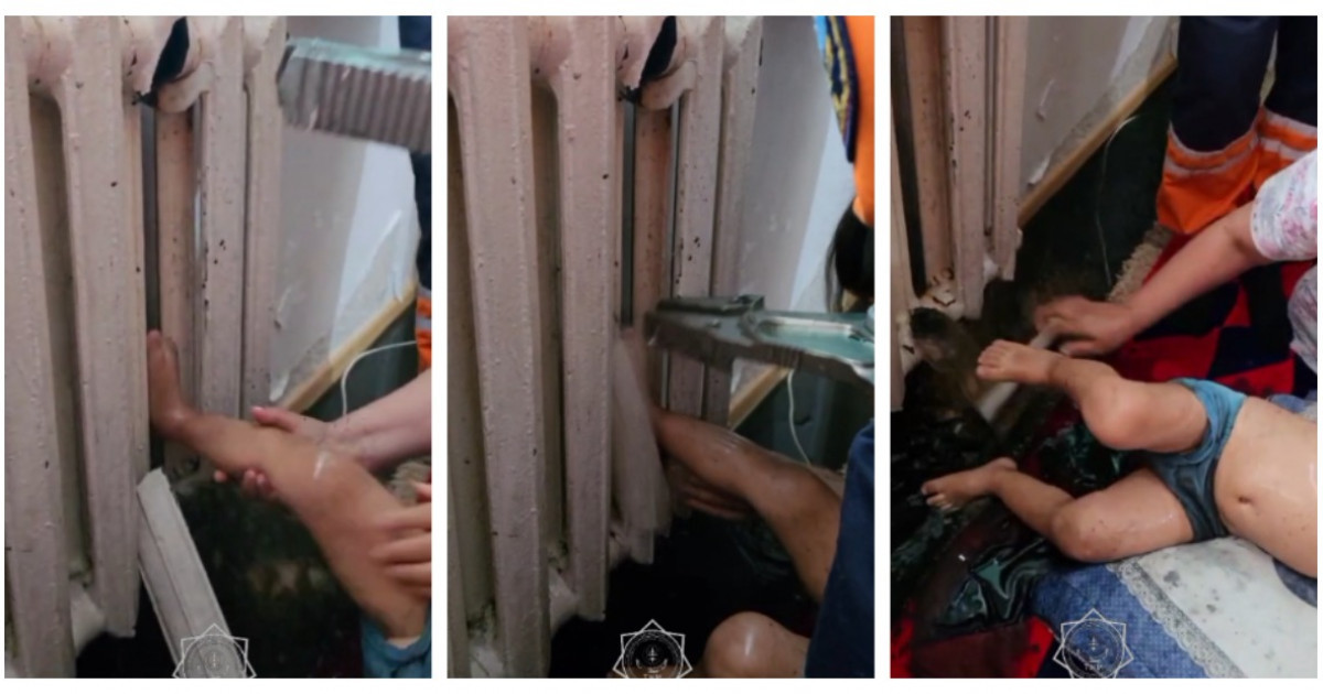 Астанада үш жасар баланың аяғы батареяға қыстырылып қалды