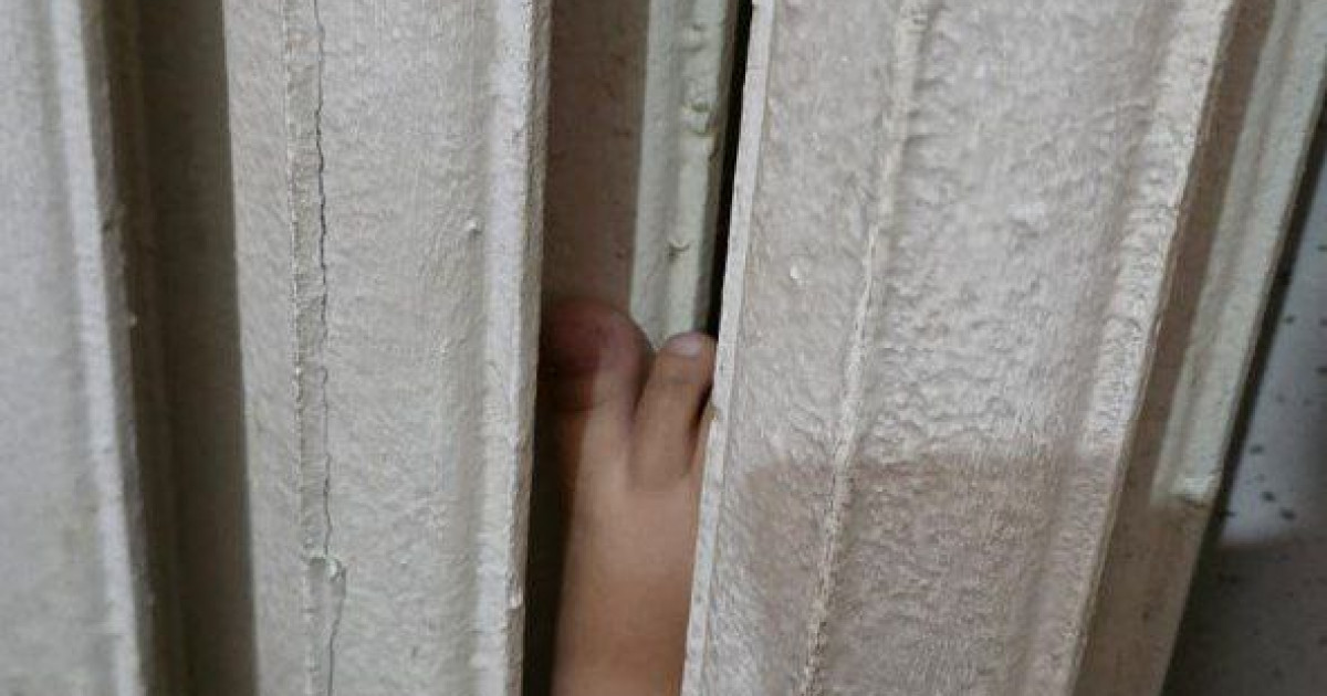 Құтқарушылар баланың аяғын босатты