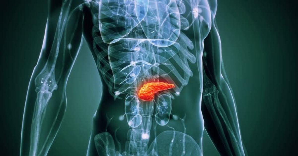 Ішімдік ішу ұйқы безі қатерлі ісігінің қаупін арттырады – зерттеу