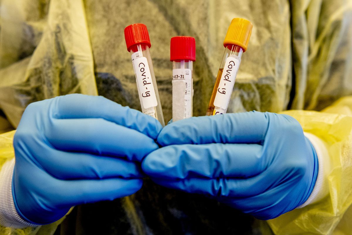 Бір тәулікте тағы 67 адамнан коронавирус анықталды