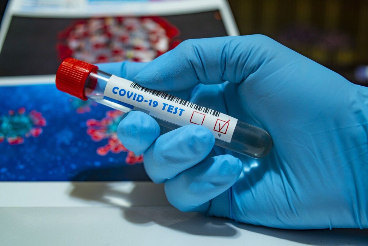 Бір тәулікте 11 мыңнан астам адамнан коронавирус анықталды