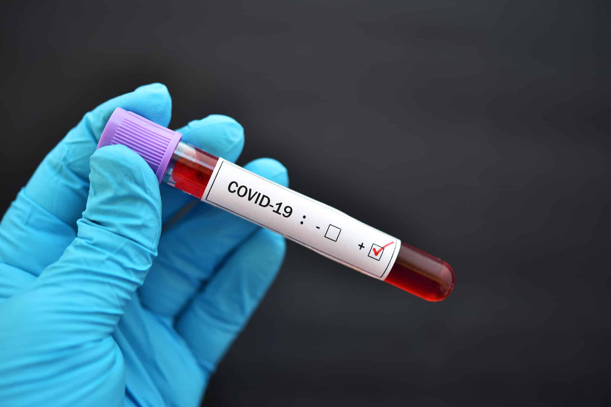 Бір тәулікте 2 200-ден астам адамнан коронавирус анықталды