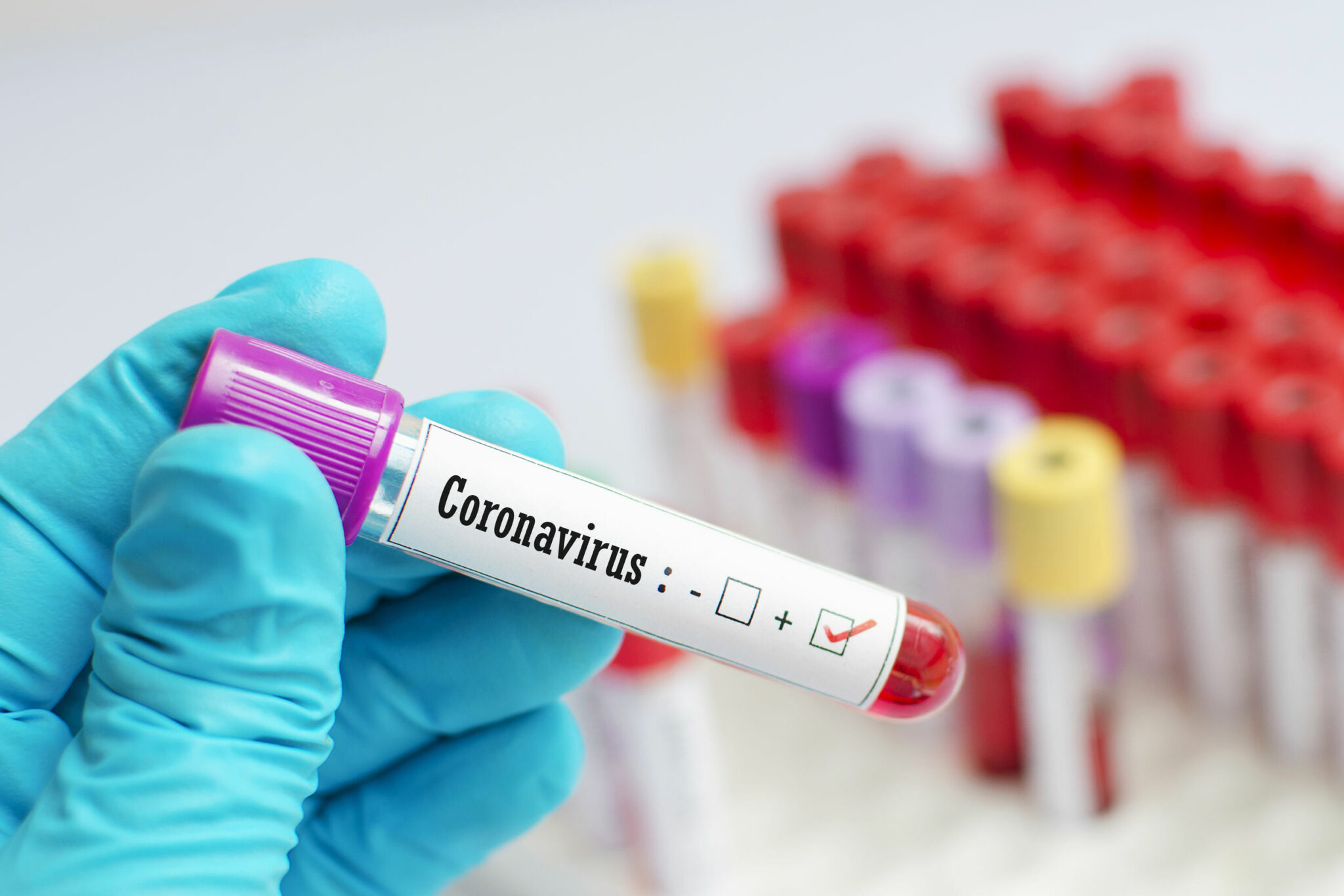 Бір тәулікте жүзден астам адамнан коронавирус анықталды