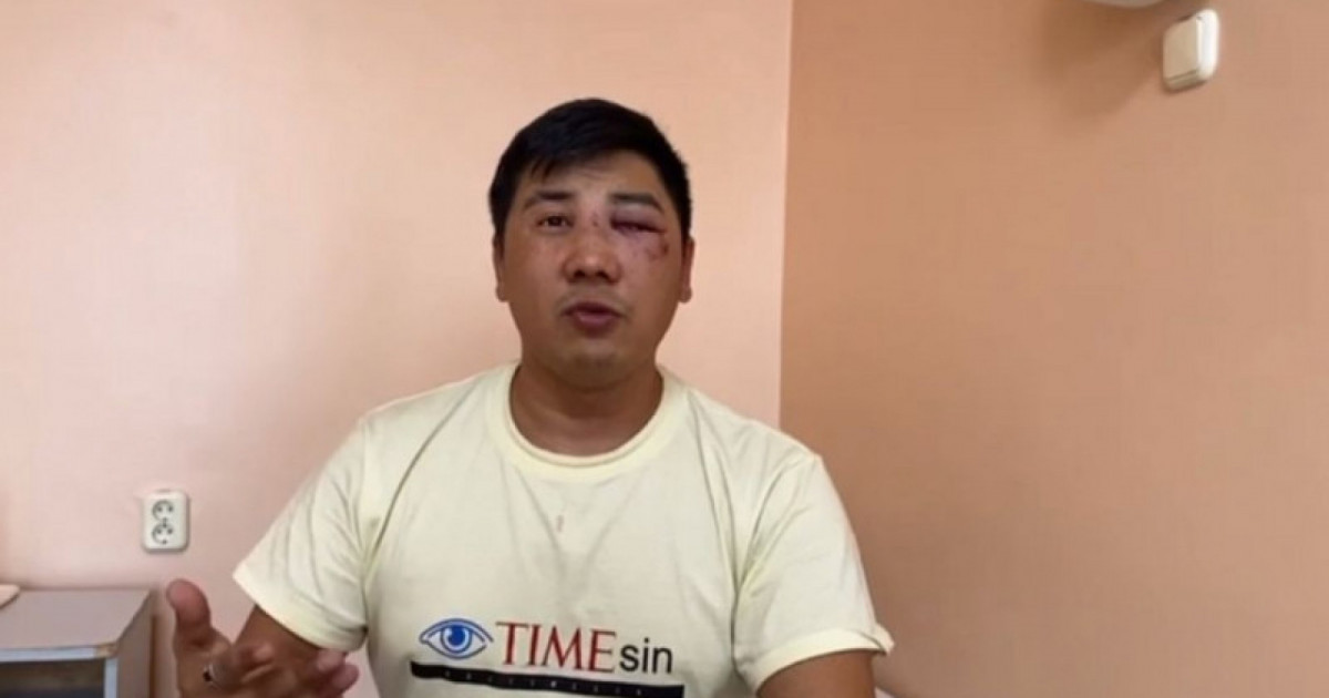 Мұрын сүйегі уатылып кеткен: соққы алған жедел жәрдем жүргізушісінің денсаулығы қандай?