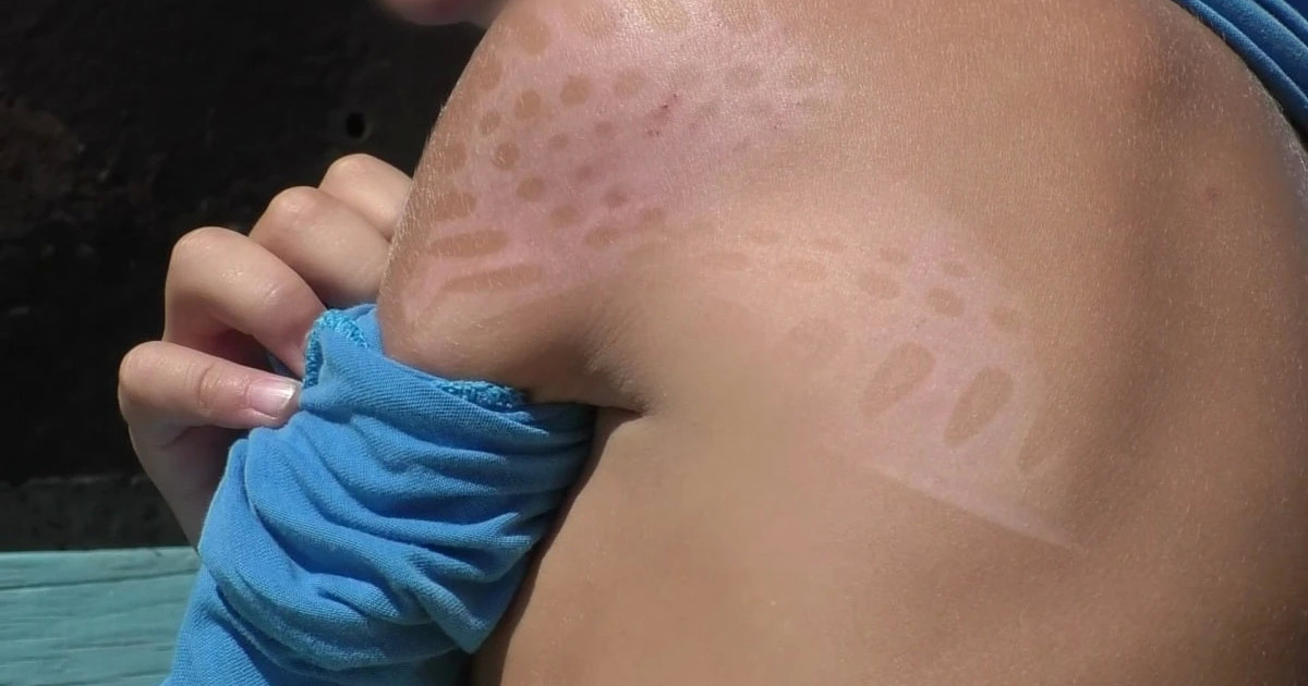 Үтік басқан: бейімдеу орталығында 7 жастағы бала жәбір көргені рас па?