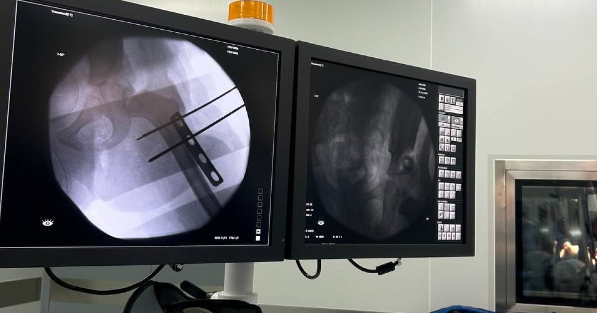 Атыраулық дәрігерлер жамбас сүйегі туабітті шығып кеткен науқасқа күрделі ота жасады