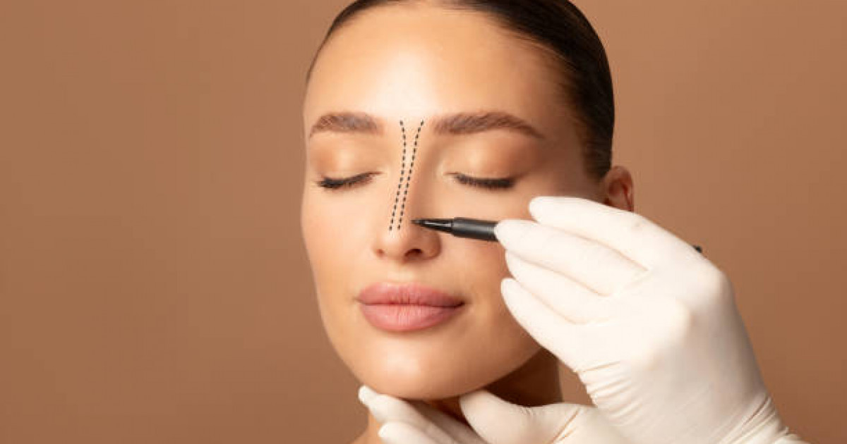 «Ринопластика дұрыс жасалмаса, қауіпті болуы мүмкін» – пластикалық хирург