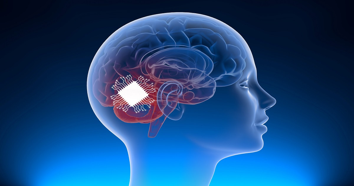 Миға қойылған имплант сіздің не ойлағаныңызды дауыстап айтып береді