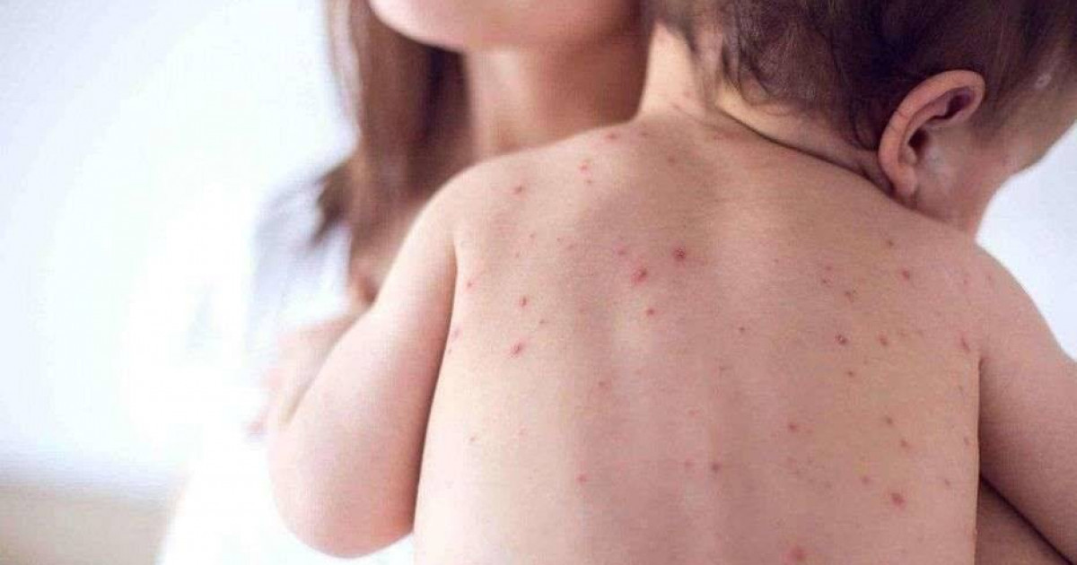 Қызылша – қорғансыз балаға қатер