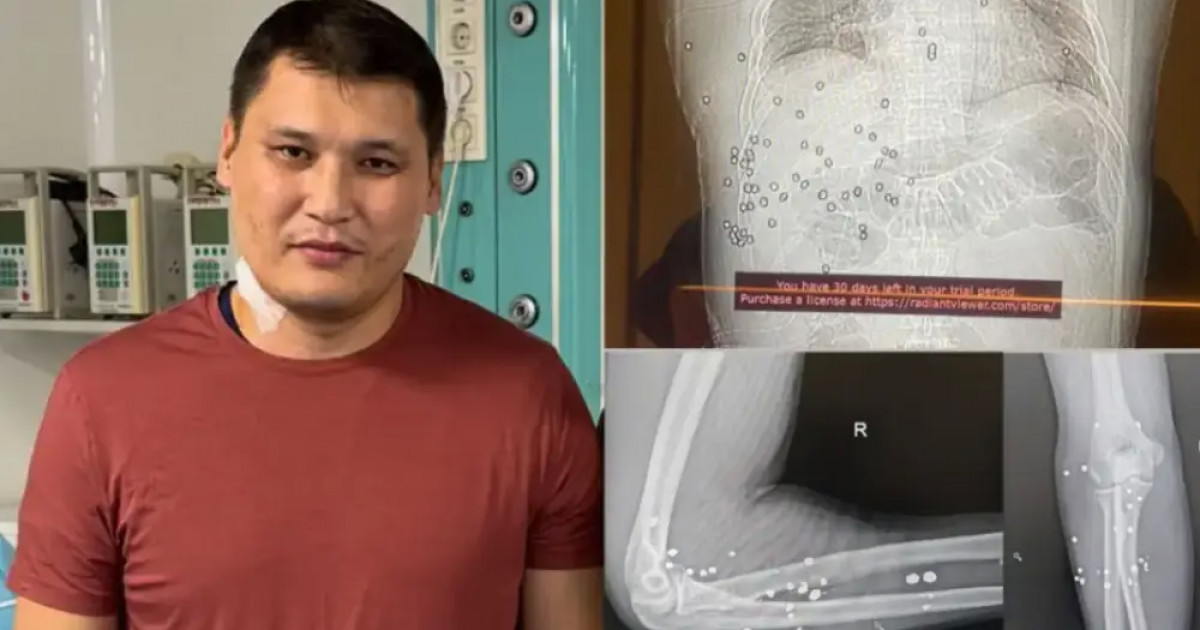 Руслан Берденовке екінші ота жасалмақ