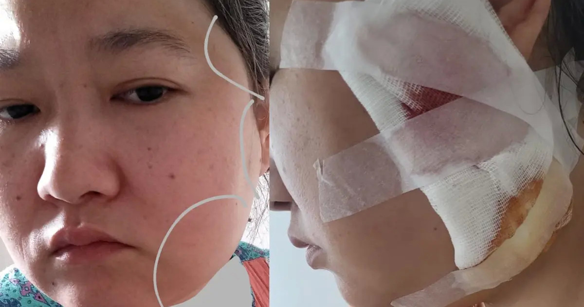 Ақтаулық тұрғын тісін емдетуге барып, соңында ота жасауға мәжбүр болған