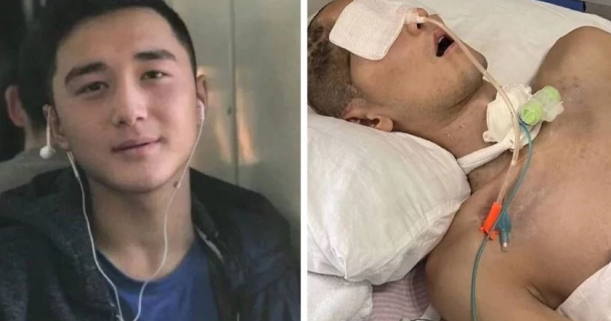 Әскерден мүгедек болып оралған Мұхтар Ербаян тағы да Түркияға ем-домға жіберілді