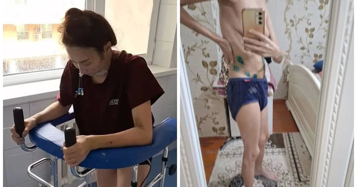 «Жарамды тіге алмады»: Талдықорған тұрғыны дәрігерлердің кесірінен қатты қиналған