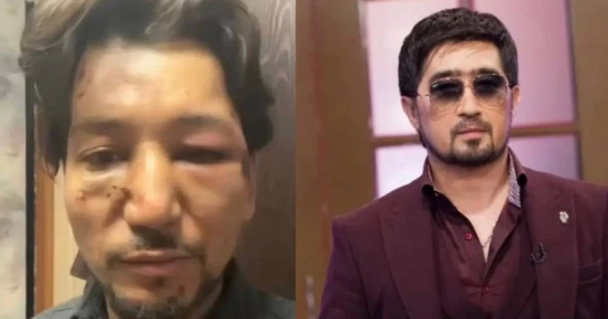 «Кешірмеймін»: әнші Ғалымжан Сүлеймен өзіне шабуыл жасағандарды жазалауды талап етті