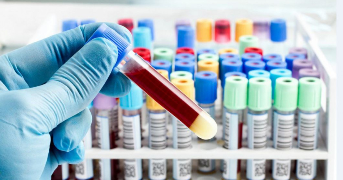 Кеселмен күрес: жетістік те, «әттеген-ай» да бар