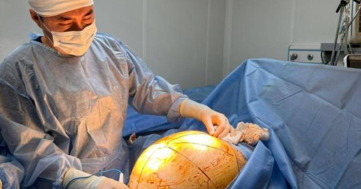 Дәрігерлер науқастың ішіндегі 25 келілік ісікті алып тастады